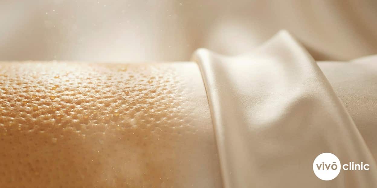 Cellulite Reduction